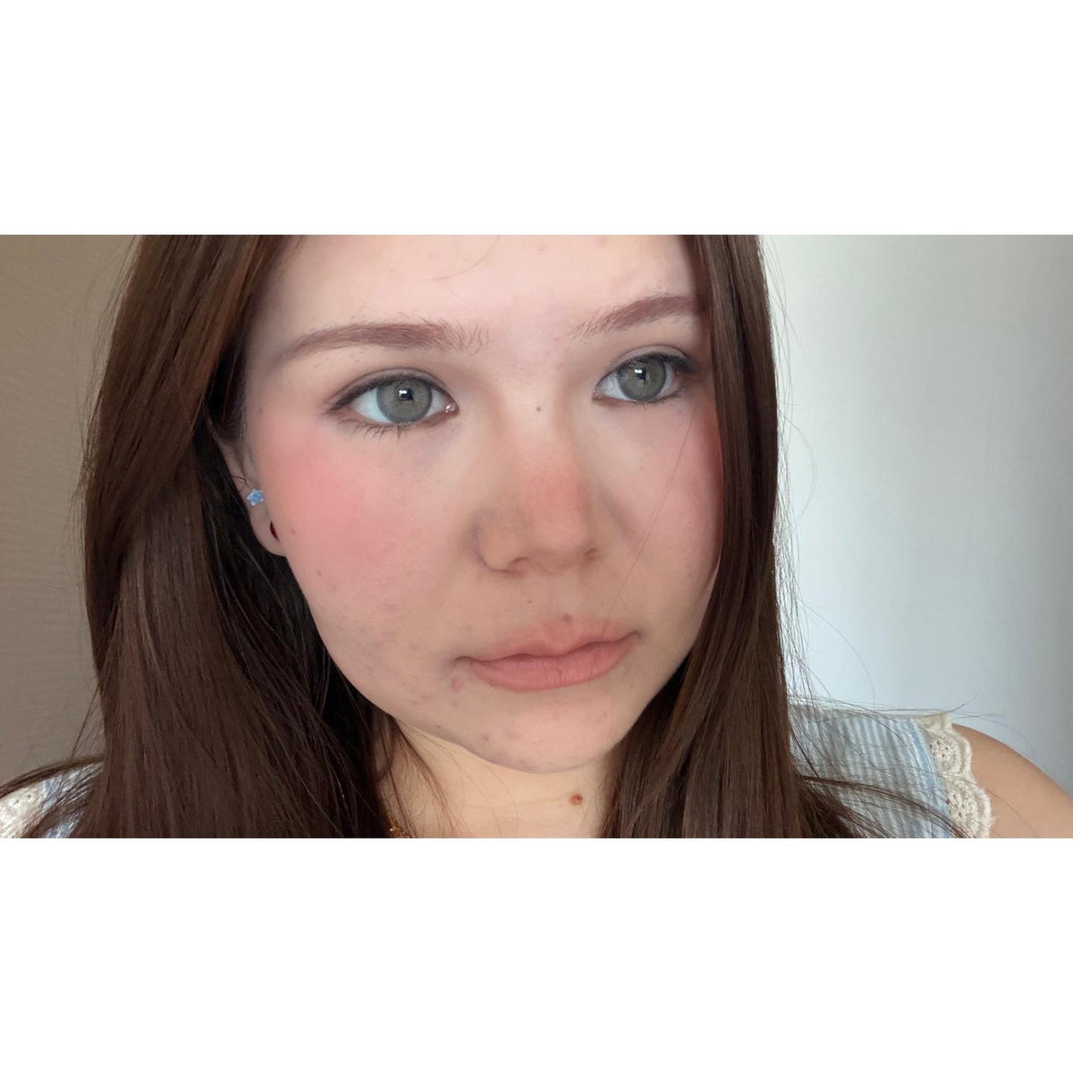 LSLAN Serltyca 14.20mm Blue Colored Contact Lenses (6 Months Wear)